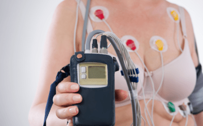 Holter Ciśnieniowy Czy Ekg: Jak Wybrać Najlepsze Badanie Dla Siebie?