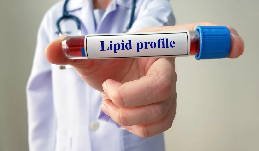 Dyslipidemie: Zrozumieć i pokonać zaburzenia lipidowe