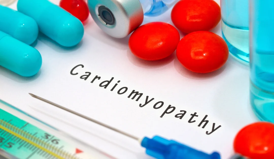 Kardiomiopatie: Choroby mięśnia sercowego