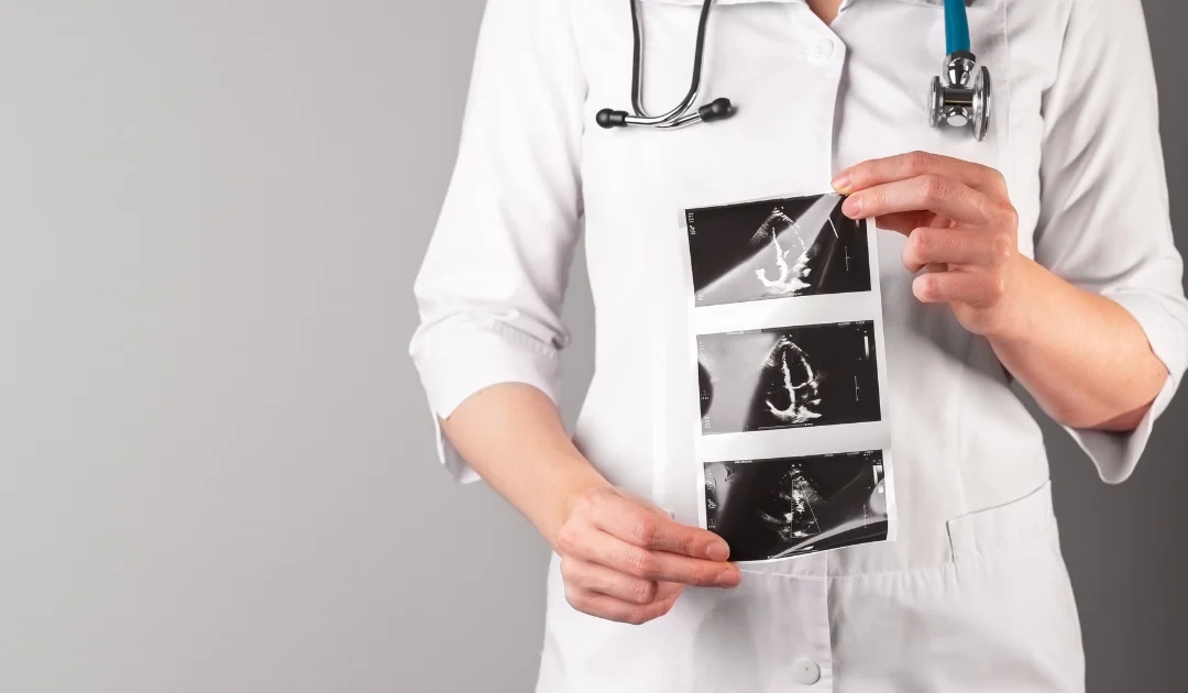 Wrodzone wady serca u dorosłych: Diagnoza, leczenie i życie z chorobą