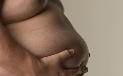 Czy Holter Ekg Jest Skuteczny U Pacjentów Z Nadwagą ?