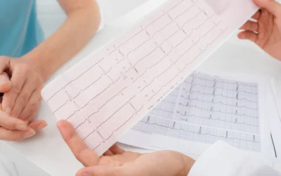 Czy Migotanie Przedsionków Można Wykryć Za Pomocą Badania Holter Ekg?