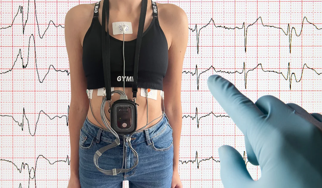 Jak diagnozować ekstrasystole za pomocą Holtera EKG