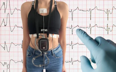 Jak Diagnozować Ekstrasystole Za Pomocą Holtera Ekg