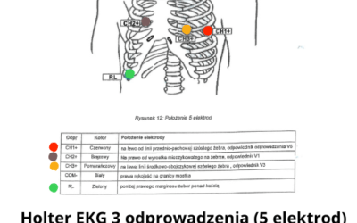 Holter Ekg Rozmieszczenie Elektrod 3-Odprowadzenia (5 Elektrod) Holter Ekg Model Bi6600