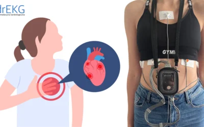 Czy Holter Ekg Może Pomóc W Ocenie Ryzyka Nagłego Zgonu Sercowego?