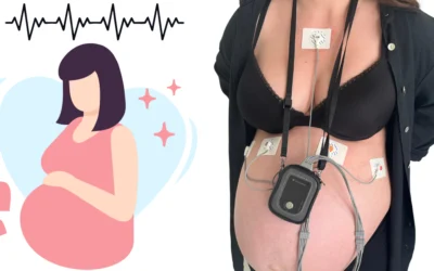 Holter Ekg W Ciąży: Diagnoza Arytmii Dla Przyszłych Mam