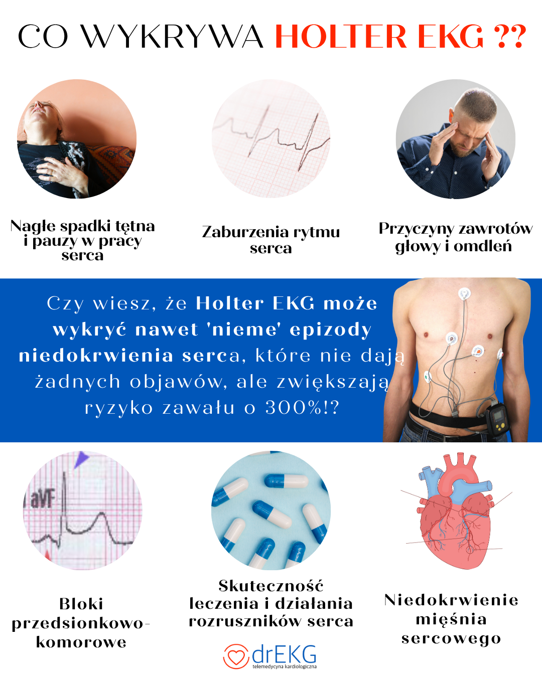 Co-wykrywa-Holter-EKG-_1 Co Wykrywa Holter Ekg?